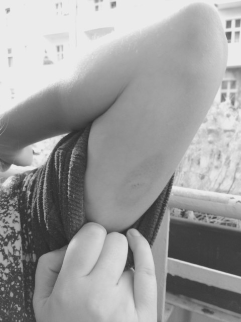 Winning by Losing – 13