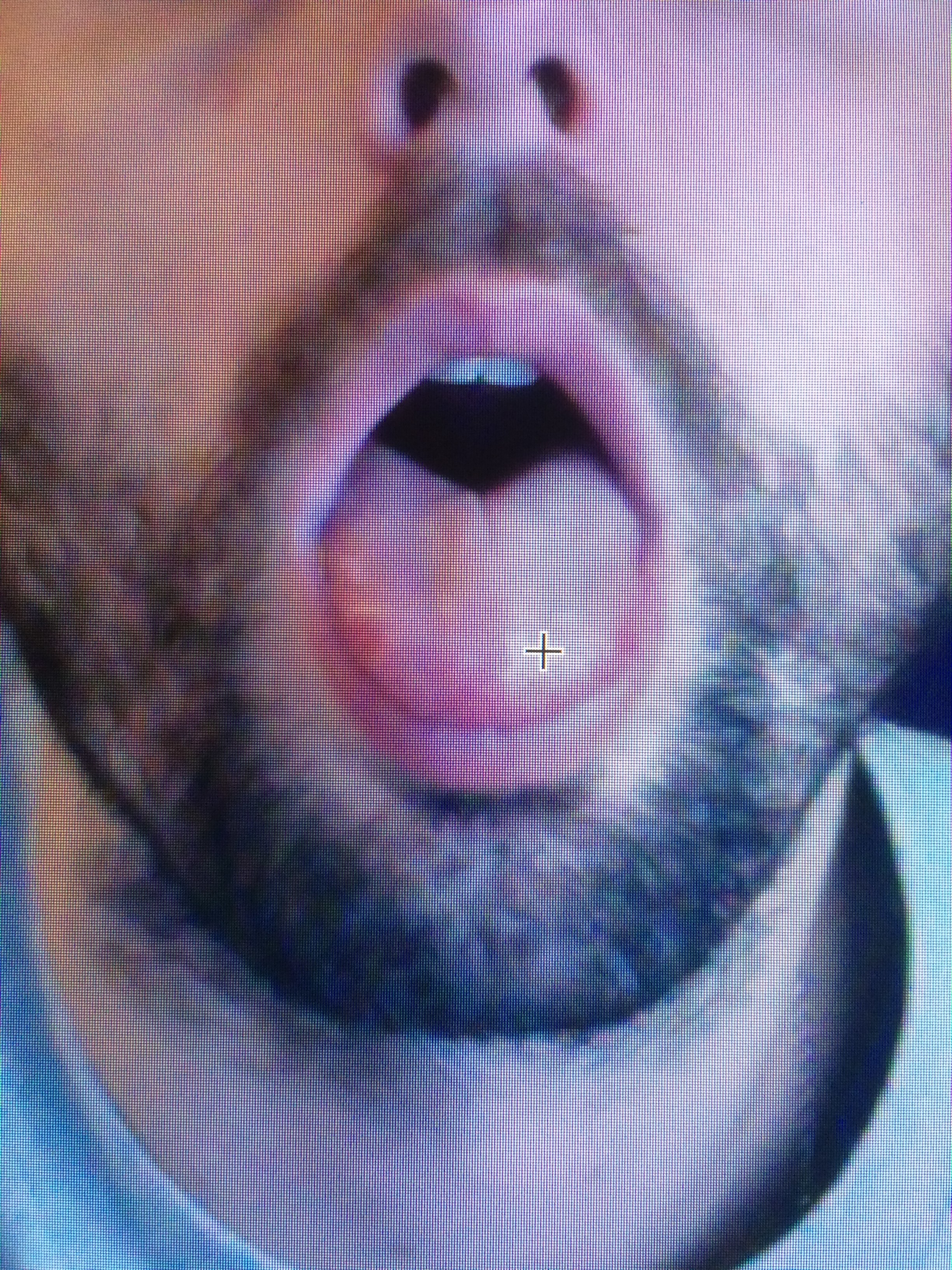 4K Lento