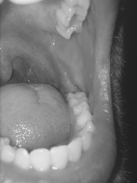 Alternative Facts – 13